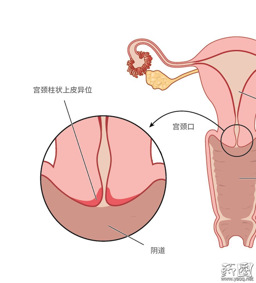 子宫后穹窿介位置图图片